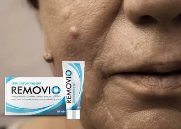 Removio kaina Lietuvoje - Oficiali svetainė